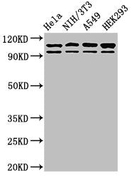 Western Blot
Positive WB detected in: Hela whole cell lysate, NIH/3T3 whole cell lysate, A549 whole cell lysate, HEK293 whole cell lysate
All lanes: MSH2 antibody at 2ug/ml
Secondary
Goat polyclonal to rabbit IgG at 1/50000 dilution
Predicted band size: 105, 98 kDa
Observed band size: 105, 98 kDa