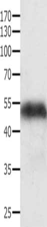Gel: 10%SDS-PAGE, Lysate: 40 ug, Lane: Mouse liver tissue, Primary antibody: CSB-PA168905(ACPP Antibody) at dilution 1/250, Secondary antibody: Goat anti rabbit IgG at 1/8000 dilution, Exposure time: 10 seconds