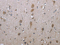The image on the left is immunohistochemistry of paraffin-embedded Human brain tissue using CSB-PA169061(GPC6 Antibody) at dilution 1/40, on the right is treated with fusion protein. (Original magnification: ×200)