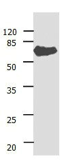 Gel: 10%SDS-PAGE Lysate: 30 ug Human liver cancer tissue lysate Primary antibody: 1/400 dilution Secondary antibody: Donkey anti Rabbit IgG - H&L (HRP) at 1/ 3000 dilution Exposure time: 1 minute