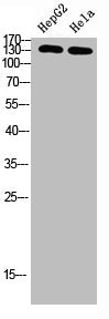 IRS2 Antibody – Figure 1 of 1