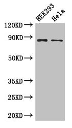 Western Blot Positive WB detected in: HEK293 whole cell lysate, Hela whole cell lysate All lanes: MLH1 antibody at 3ug/ml Secondary Goat polyclonal to rabbit IgG at 1/50000 dilution Predicted band size: 85, 59, 74 kDa Observed band size: 85 kDa