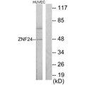 Western blot analysis of extracts from HUVEC cells, using ZNF24 antibody.