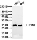 Western Blot
Positive WB detected in: recombinant protein
All lanes:HEI10 Antibody at 1:1000
Secondary
Goat polyclonal to rabbit IgG at 1/20000 dilution
Predicted band size: 30.1 kDa
Observed band size: 36 kDa