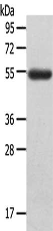 Gel: 8%SDS-PAGE,Lysate: 40 ug,,Primary antibody: CSB-PA172061(LAG3 Antibody) at dilution 1/148 dilution,Secondary antibody: Goat anti rabbit IgG at 1/8000 dilution,Exposure time: 3 minutes