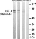 Western blot analysis of extracts from HepG2 cells, A549 cells and LOVO cells all treated with nocodazole (1ug/ml, 18hours), using p63 (Phospho-Ser395) antibody. The lane on the right is treated with the synthesized peptide.