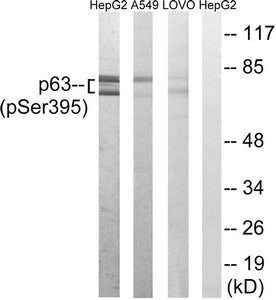 Western blot analysis of extracts from HepG2 cells, A549 cells and LOVO cells all treated with nocodazole (1ug/ml, 18hours), using p63 (Phospho-Ser395) antibody. The lane on the right is treated with the synthesized peptide.