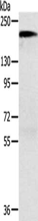 Gel: 6%SDS-PAGE, Lysate: 40 ug, Lane: Mouse kidney tissue, Primary antibody: CSB-PA172536(ACE Antibody) at dilution 1/1000, Secondary antibody: Goat anti rabbit IgG at 1/8000 dilution, Exposure time: 30 seconds