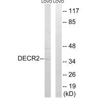 Western blot analysis of extracts from LOVO cells, using DECR2 antibody.
