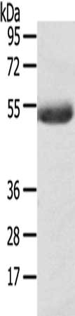 Gel: 8%SDS-PAGE, Lysate: 40 ug, Lane: Mouse plasma tissue, Primary antibody: CSB-PA173647(AGPAT6  Antibody) at dilution 1/400, Secondary antibody: Goat anti rabbit IgG at 1/8000 dilution, Exposure time: 5 minutes