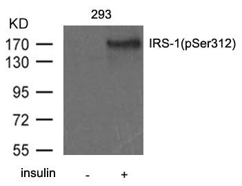 Western blot analysis of extract from 293 cells untreated or treated with insulin using IRS-1(Phospho-Ser312) antibody.