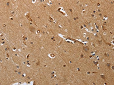 The image on the left is immunohistochemistry of paraffin-embedded Human brain tissue using CSB-PA174197(PODXL Antibody) at dilution 1/20, on the right is treated with synthetic peptide. (Original magnification: ×200)