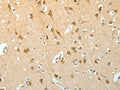 The image on the left is immunohistochemistry of paraffin-embedded Human brain tissue using CSB-PA174241(SCG3 Antibody) at dilution 1/15, on the right is treated with fusion protein. (Original magnification: ×200)