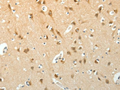 The image on the left is immunohistochemistry of paraffin-embedded Human brain tissue using CSB-PA174241(SCG3 Antibody) at dilution 1/15, on the right is treated with fusion protein. (Original magnification: ×200)