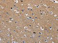 The image on the left is immunohistochemistry of paraffin-embedded Human brain tissue using CSB-PA174920(GSTA2 Antibody) at dilution 1/50, on the right is treated with fusion protein. (Original magnification: ×200)