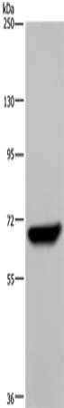 Gel: 6%SDS-PAGE, Lysate: 40 ug, Lane: Raji cells, Primary antibody: CSB-PA174975(LCP1 Antibody) at dilution 1/250, Secondary antibody: Goat anti rabbit IgG at 1/8000 dilution, Exposure time: 10 seconds