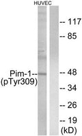 Western blot analysis of extracts from HUVEC cells treated with PMA using Pim-1 (Phospho-Tyr309) Antibody.The lane on the right is treated with the antigen-specific peptide.