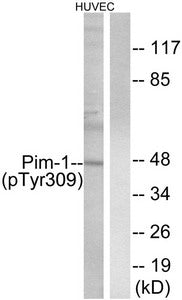 Western blot analysis of extracts from HUVEC cells treated with PMA using Pim-1 (Phospho-Tyr309) Antibody.The lane on the right is treated with the antigen-specific peptide.