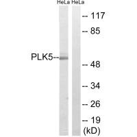 Western blot analysis of extracts from COLO cells, Jurkat cells and HeLa cells, using PLK5 antibody.