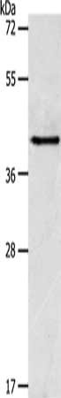 Gel: 10%SDS-PAGE, Lysate: 40 ug, Lane: MCF7 cells, Primary antibody: CSB-PA175287(ACTR1A Antibody) at dilution 1/300, Secondary antibody: Goat anti rabbit IgG at 1/8000 dilution, Exposure time: 10 seconds