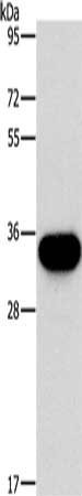 Gel: 15%SDS-PAGE, Lysate: 40 ug, Lane: PC3 cells, Primary antibody: CSB-PA175658(HOXB13 Antibody) at dilution 1/900, Secondary antibody: Goat anti rabbit IgG at 1/8000 dilution, Exposure time: 10 seconds