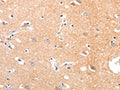 The image on the left is immunohistochemistry of paraffin-embedded Human brain tissue using CSB-PA176985(MAPK8 Antibody) at dilution 1/50, on the right is treated with synthetic peptide. (Original magnification: ×200)