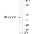 Western blot analysis of extracts from HepG2 cells, treated with Anisomycin (0.5uM, 5hours), using IKK-γ (Ab-85) antibody.