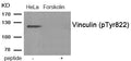 Western blot analysis of extracts from HeLa cells treated with Forskolin using Phospho-Vinculin (Tyr822) antibody.The lane on the right is treated with the antigen-specific peptide.