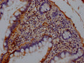IHC image of CSB-PA17772A0Rb diluted at 1:140 and staining in paraffin-embedded human small intestine tissue performed on a Leica BondTM system. After dewaxing and hydration, antigen retrieval was mediated by high pressure in a citrate buffer (pH 6.0). Section was blocked with 10% normal goat serum 30min at RT. Then primary antibody (1% BSA) was incubated at 4°C overnight. The primary is detected by a Goat anti-rabbit IgG labeled by HRP and visualized using 0.05% DAB.