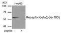 Western blot analysis of extracts from HepG2 tissue using Estrogen Receptor- beta (Phospho-Ser105) antibody.The lane on the right is treated with the antigen-specific peptide.