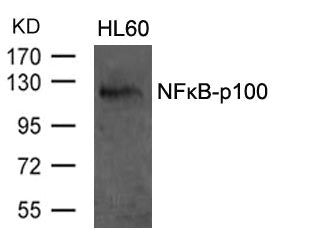 Western blot analysis of extracts from HL60 cells using NFkB-p100(Ab-870) Antibody.