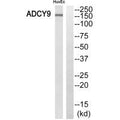 Western blot analysis of extracts from HuvEc cells, using ADCY9 antibody.