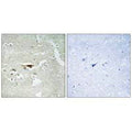 Immunohistochemistry analysis of paraffin-embedded human brain tissue, using IPKB antibody.