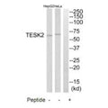 Western blot analysis of extracts from HepG2 cells and HeLa cells, using TESK2 antibody.