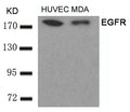 Western blot analysis of extracts from HUVEC and MDA cells using EGFR(Ab-693) Antibody.