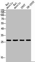 Western blot analysis of RAT-MUSLE RAT-SPLEEN 293T SH-SY5Y using IL26 antibody. Antibody was diluted at 1:2000. Secondary antibody  was diluted at 1:20000