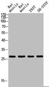Western blot analysis of RAT-MUSLE RAT-SPLEEN 293T SH-SY5Y using IL26 antibody. Antibody was diluted at 1:2000. Secondary antibody  was diluted at 1:20000