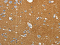 The image on the left is immunohistochemistry of paraffin-embedded Human brain tissue using CSB-PA180041(SSTR4 Antibody) at dilution 1/25, on the right is treated with synthetic peptide. (Original magnification: ×200)