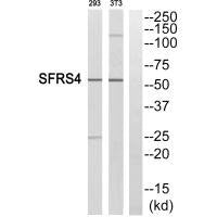Western blot analysis of extracts from LOVO cells, using SFRS4 antibody.