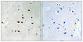 Immunohistochemical analysis of paraffin-embedded human brain tissue using ITCH (Phospho-Tyr420) antibody (left)or the same antibody preincubated with blocking peptide (right).