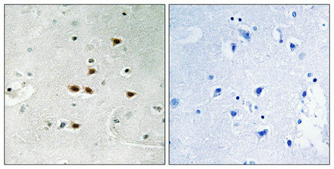 Immunohistochemical analysis of paraffin-embedded human brain tissue using ITCH (Phospho-Tyr420) antibody (left)or the same antibody preincubated with blocking peptide (right).