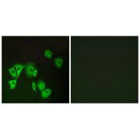 Immunofluorescence analysis of A549 cells, using TTF2 antibody.