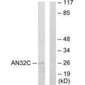Western blot analysis of extracts from HUVEC cells, using AN32C antibody.