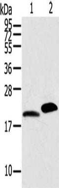 Gel: 12%SDS-PAGE, Lysate: 40 ug, Lane 1-2: Mouse skin tissue, Mouse heart tissue, Primary antibody: CSB-PA181376(MYL2 Antibody) at dilution 1/800, Secondary antibody: Goat anti rabbit IgG at 1/8000 dilution, Exposure time: 30 seconds