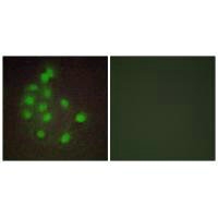 Immunofluorescence analysis of A549 cells, using HAND1 antibody.