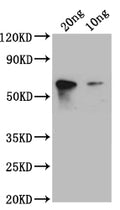 Western Blot
Positive WB detected in: recombinant protein
All lanes: S1 Antibody at 1:1000
Secondary
Goat polyclonal to rabbit IgG at 1/50000 dilution
Predicted band size: 45 kDa
Observed band size: 45 kDa