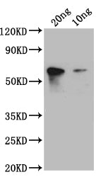 Western Blot
Positive WB detected in: recombinant protein
All lanes: S1 Antibody at 1:1000
Secondary
Goat polyclonal to rabbit IgG at 1/50000 dilution
Predicted band size: 45 kDa
Observed band size: 45 kDa