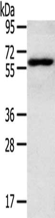 Gel: 8%SDS-PAGE, Lysate: 40 ug, Lane: TM4 cells, Primary antibody: CSB-PA182231(RORA Antibody) at dilution 1/400, Secondary antibody: Goat anti rabbit IgG at 1/8000 dilution, Exposure time: 3 minutes
