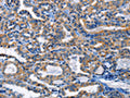HCK Antibody – Figure 1 of 3
