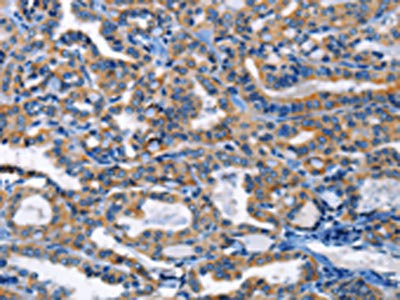 HCK Antibody – Figure 1 of 3